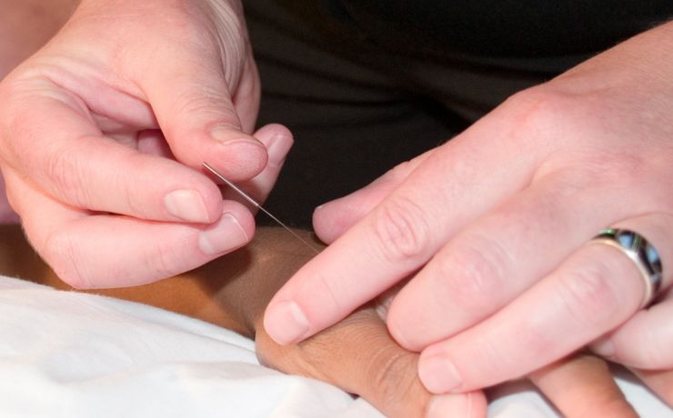 Stressregulatie met acupunctuur; Body-Mind als een(heid)