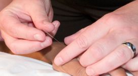 Stress-en Emotieregulatie in de acupunctuur-praktijk; Body-Mind als een(heid)